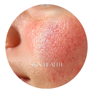 🔴 What Exactly Does Red Light Therapy Do? 2 Skin Health