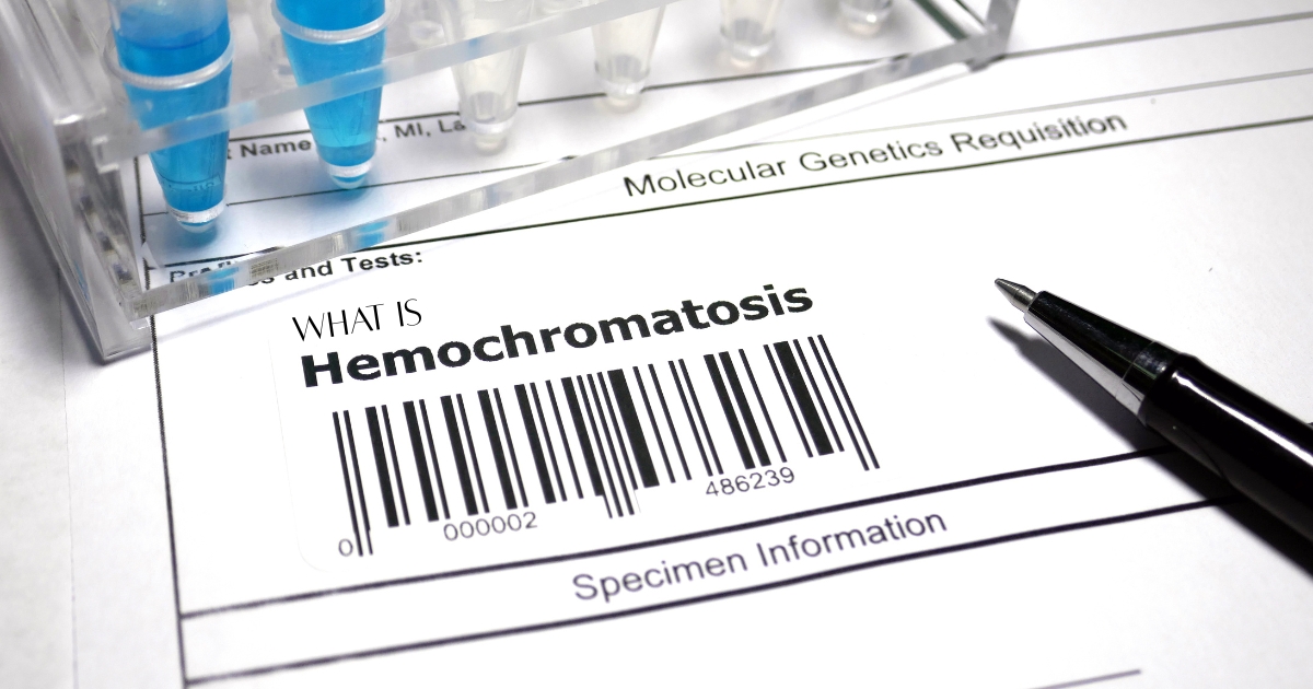 😵What are the symptoms of haemochromatosis 2 At what age does hemochromatosis start?